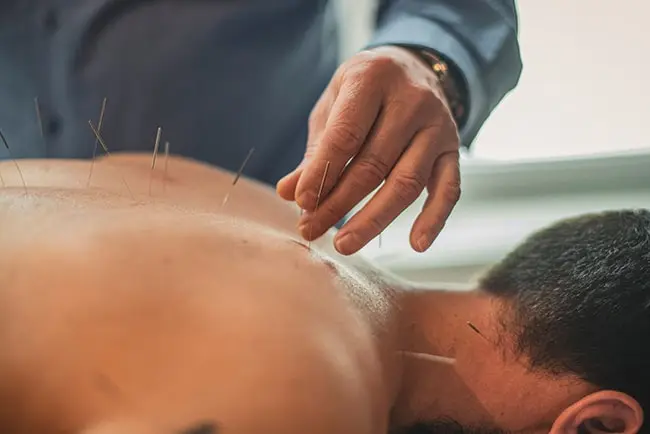 Acupuntura Deportiva