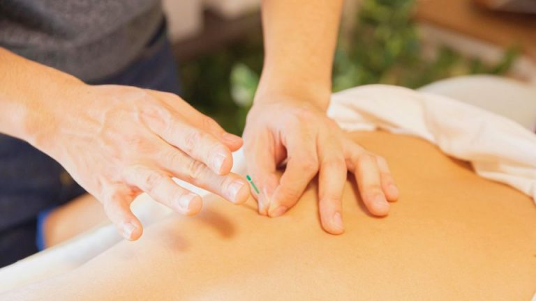 Acupuntura para dormir mejor: guía práctica con enfoque en deportistas