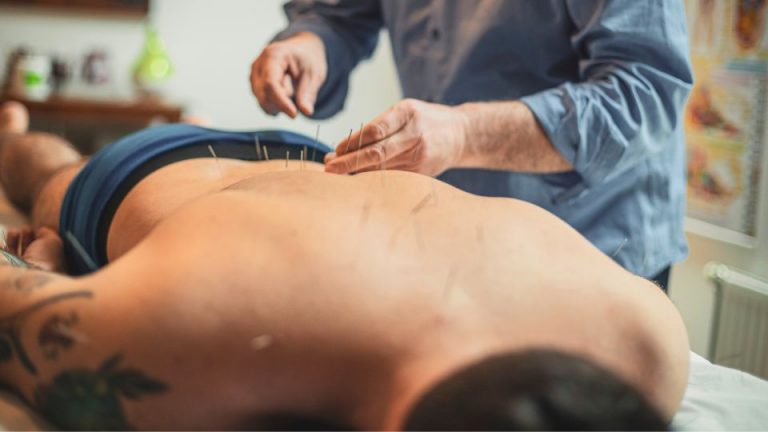 ¿Qué es la acupuntura deportiva? Guía clara para deportistas en Perú